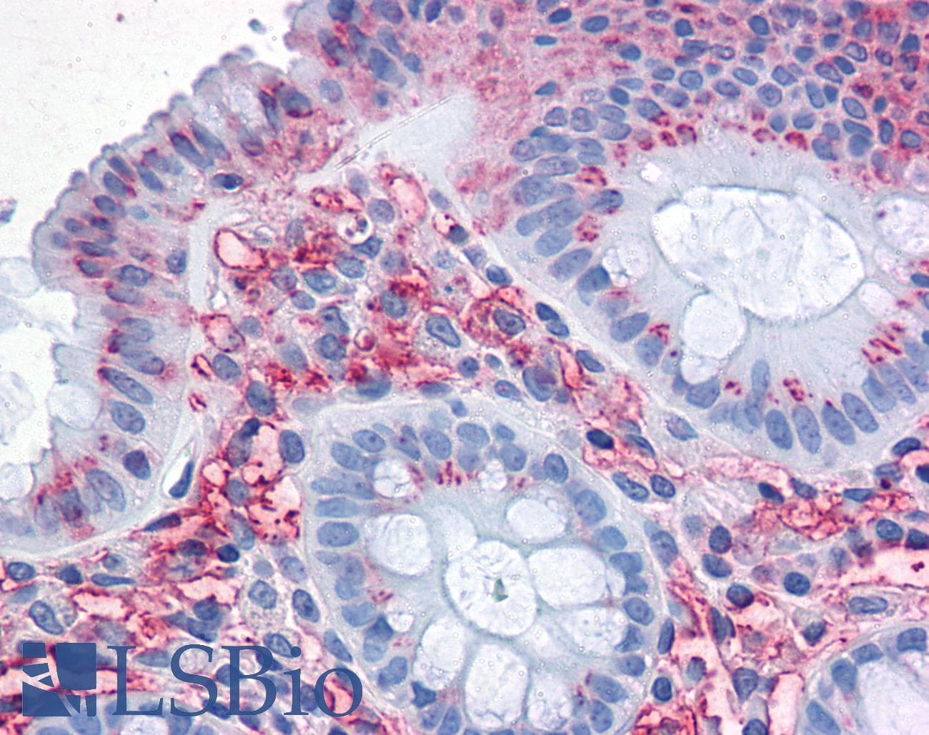 IHC-plus™ Polyclonal Rabbit anti-Human SLC1A5 / ASCT2 Antibody (Internal, IHC)