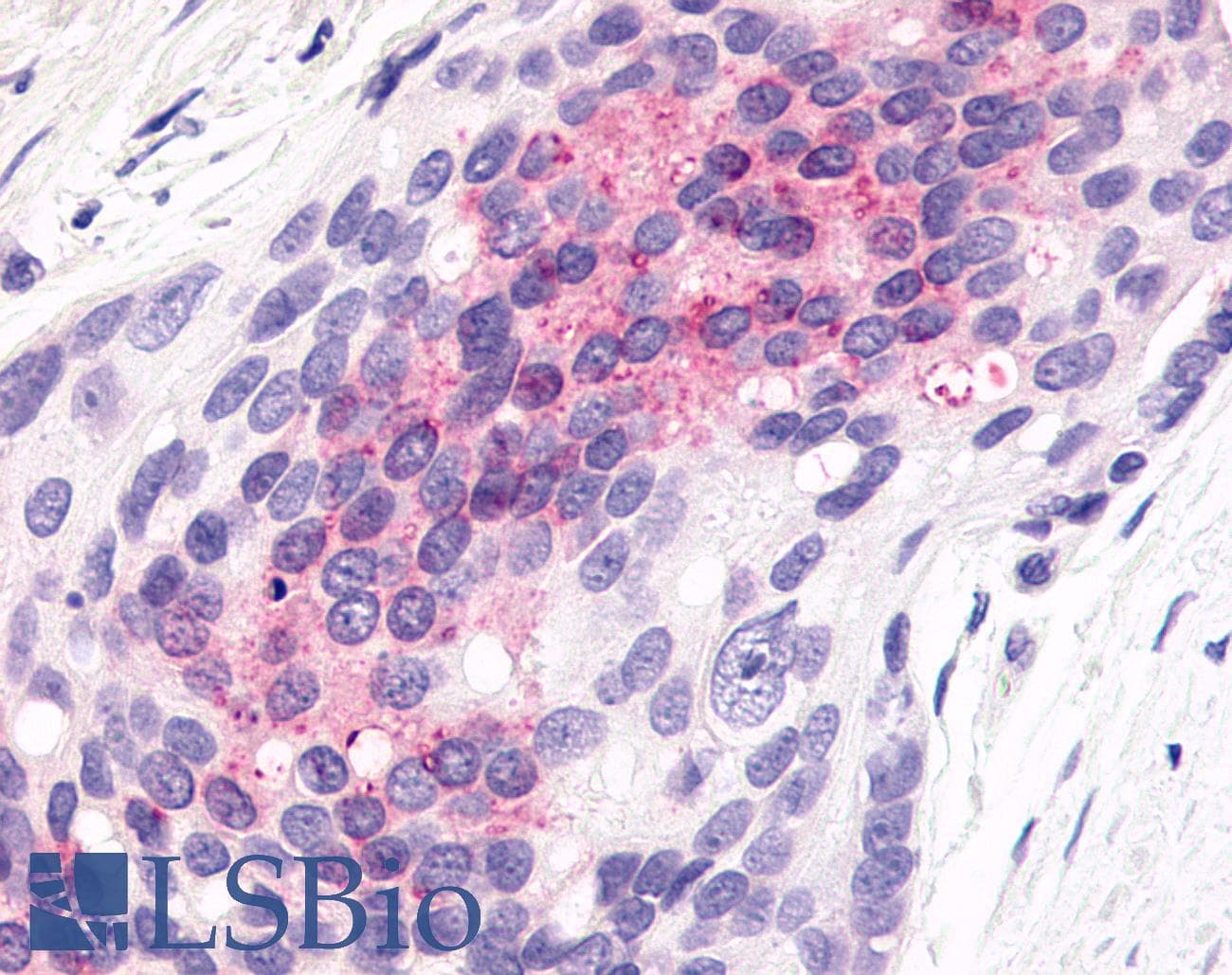PathPlus™ Polyclonal Rabbit anti-Human ADGRL4 / ELTD1 Antibody (C-Terminus, IHC)