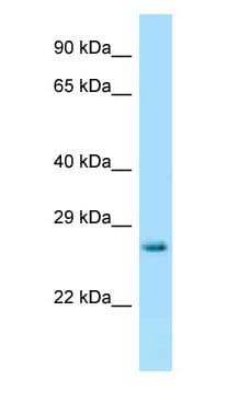 Polyclonal Rabbit anti-Mouse HPRT1 / HPRT Antibody (C-Terminus, WB)