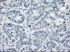 PPP5C Antibody (clone OTI6C2)