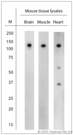 CACNA2D1 Antibody (aa600-650)