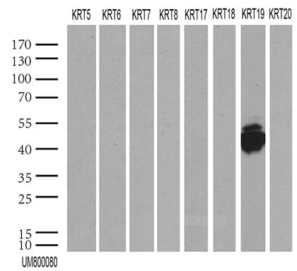 Monoclonal Mouse anti-Human KRT19 / CK19 / Cytokeratin 19 Antibody (clone UMAB188, aa240-390, IHC, IF, WB)