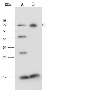 PGM2 Antibody