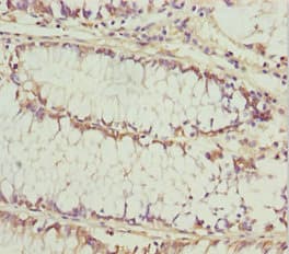 KERA / Keratocan Antibody