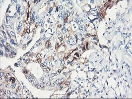 SERPINB2 / PAI-2 Antibody (clone OTI1E3, Carrier-free)