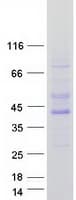 Human PRKAB1 / AMPK Beta 1 Protein (Recombinant Myc-DDK (Flag))