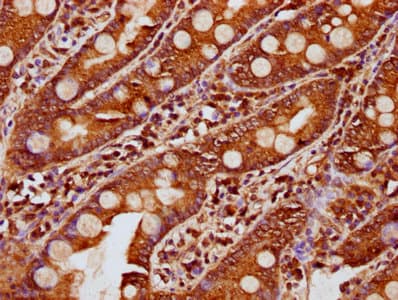 Polyclonal Rabbit anti-Human KLB / Beta Klotho Antibody (IHC)