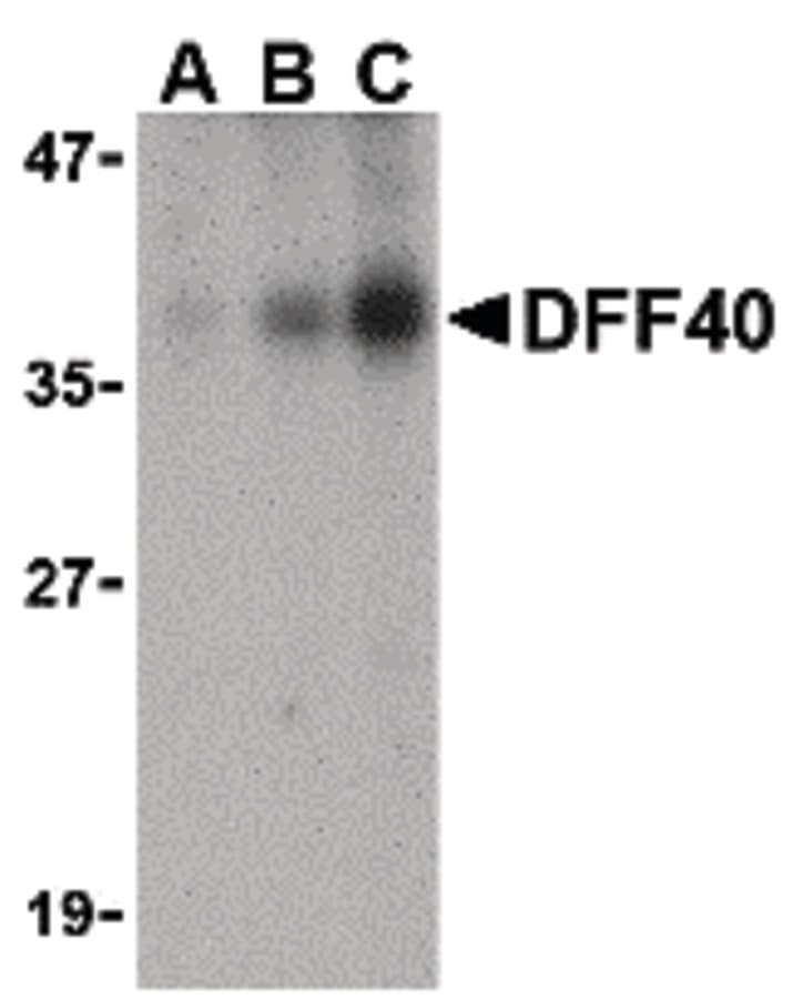 Polyclonal Rabbit anti-Human DFFB Antibody (WB)