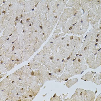 Polyclonal Rabbit anti-Human PPP2R5C Antibody (IHC, WB)