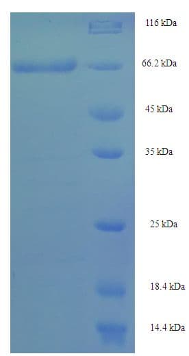 Human SEPT7 / Septin 7 Protein (Recombinant His-SUMO)