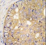 GJB6 / CX30 / Connexin 30 Antibody (aa87-117)