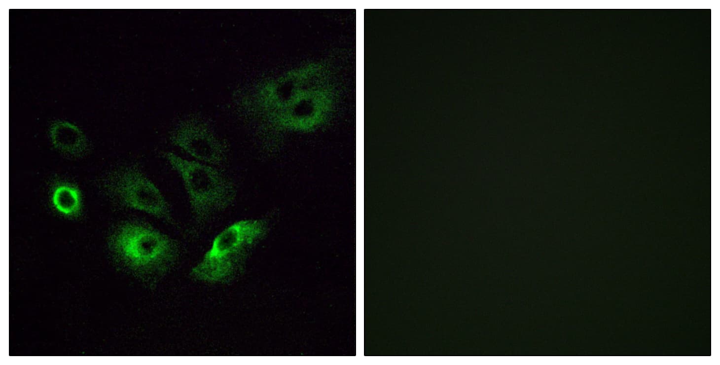 OR4Q3 Antibody (aa264-313)
