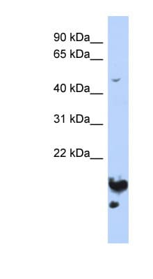 NUSAP1 / NUSAP Antibody (aa143-192)