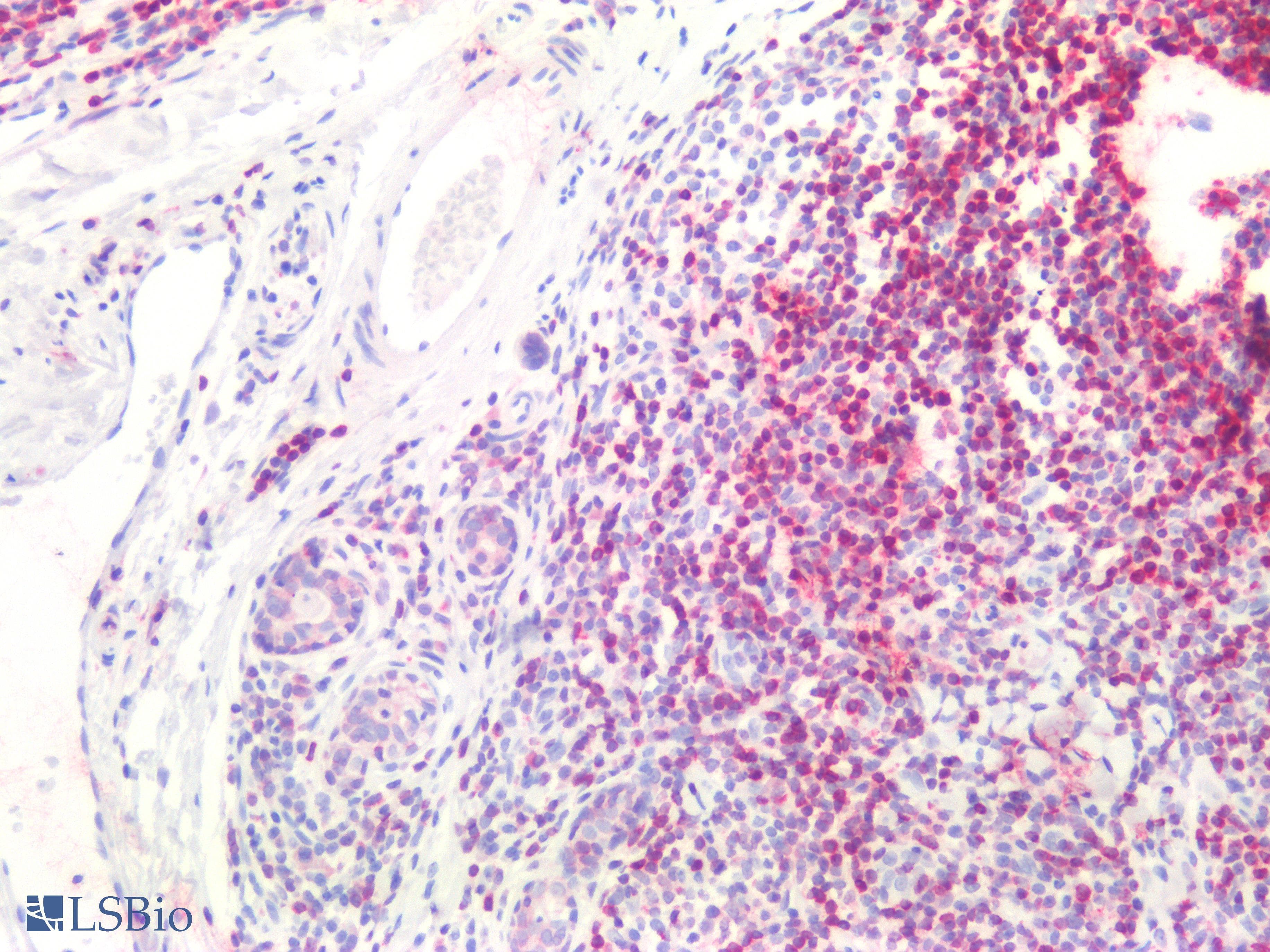 IHC-plus™ Monoclonal Mouse anti-Human BCL2 / Bcl-2 Antibody (clone Bcl-2/100, aa41-54, IHC, WB)
