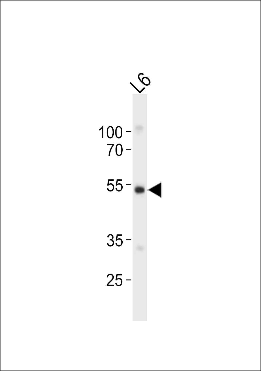 Polyclonal Rabbit anti-Mouse FGR Antibody (aa232-265, WB)