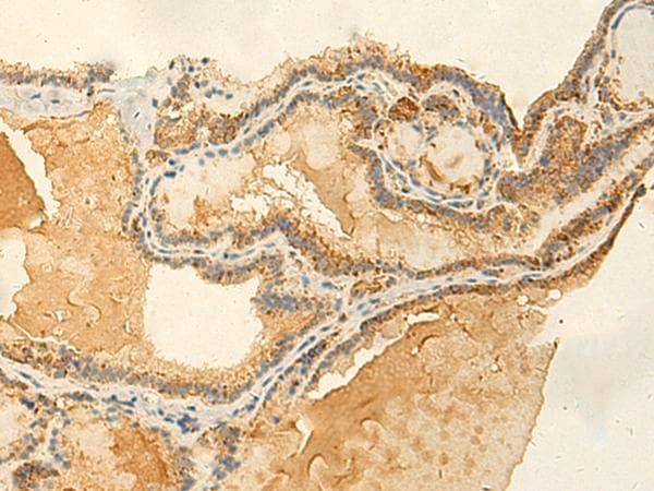 RNF148 Antibody