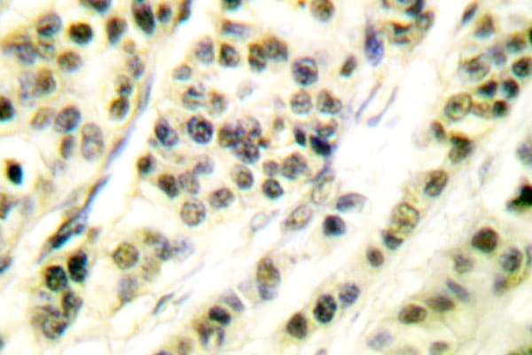 SKP1 Antibody (Pro72)