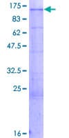 Human TROAP Protein (Recombinant GST)