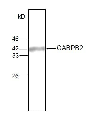 Monoclonal Mouse anti-Human GABPB2 Antibody (WB)
