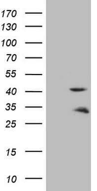 Monoclonal Mouse anti-Human TNNT2 / CTNT Antibody (clone OTI8B5, Carrier-free, IHC, WB)