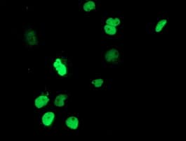 UNG / Uracil DNA Glycosylase Antibody (clone OTI1B6, Carrier-free)