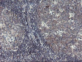 Monoclonal Mouse anti-Human DPH2 Antibody (clone OTI1A12, IHC, WB)