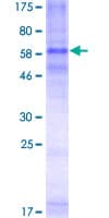 Human CCR3 Protein (Recombinant GST)