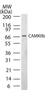 CAMK2B / CaMKII Beta Antibody (aa499-513)