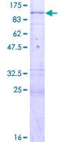 Human PAK6 Protein (Recombinant GST)