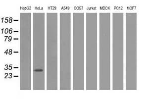 GSTT2 Antibody (clone OTI2E3)