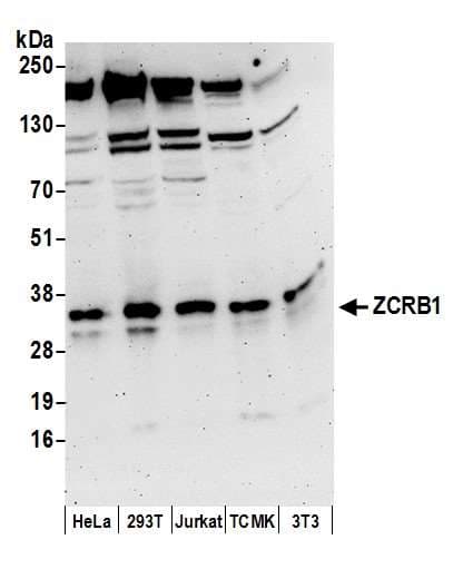 ZCRB1 Antibody (aa155-205)
