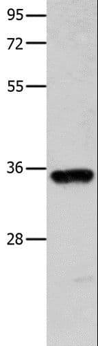 Polyclonal Rabbit anti-Human COX11 Antibody (IHC, WB)