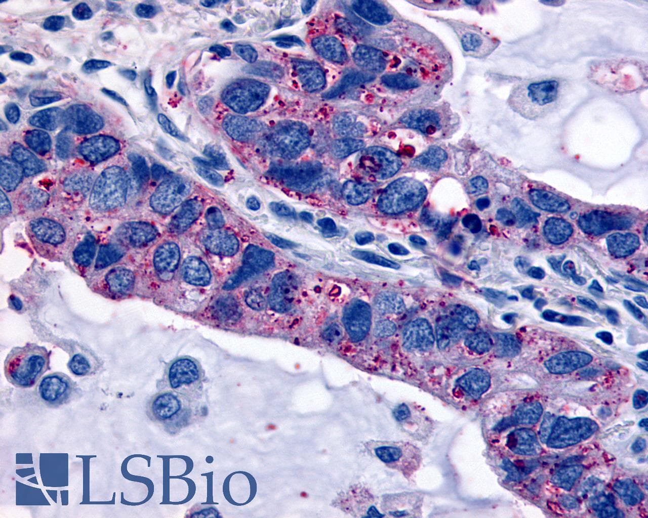 PathPlus™ Polyclonal Rabbit anti-Human OXTR / Oxytocin Receptor Antibody (Cytoplasmic Domain, IHC)
