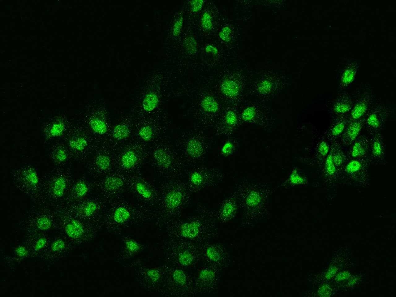 ZNF384 Antibody
