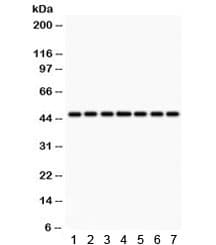 IDH1 / IDH Antibody