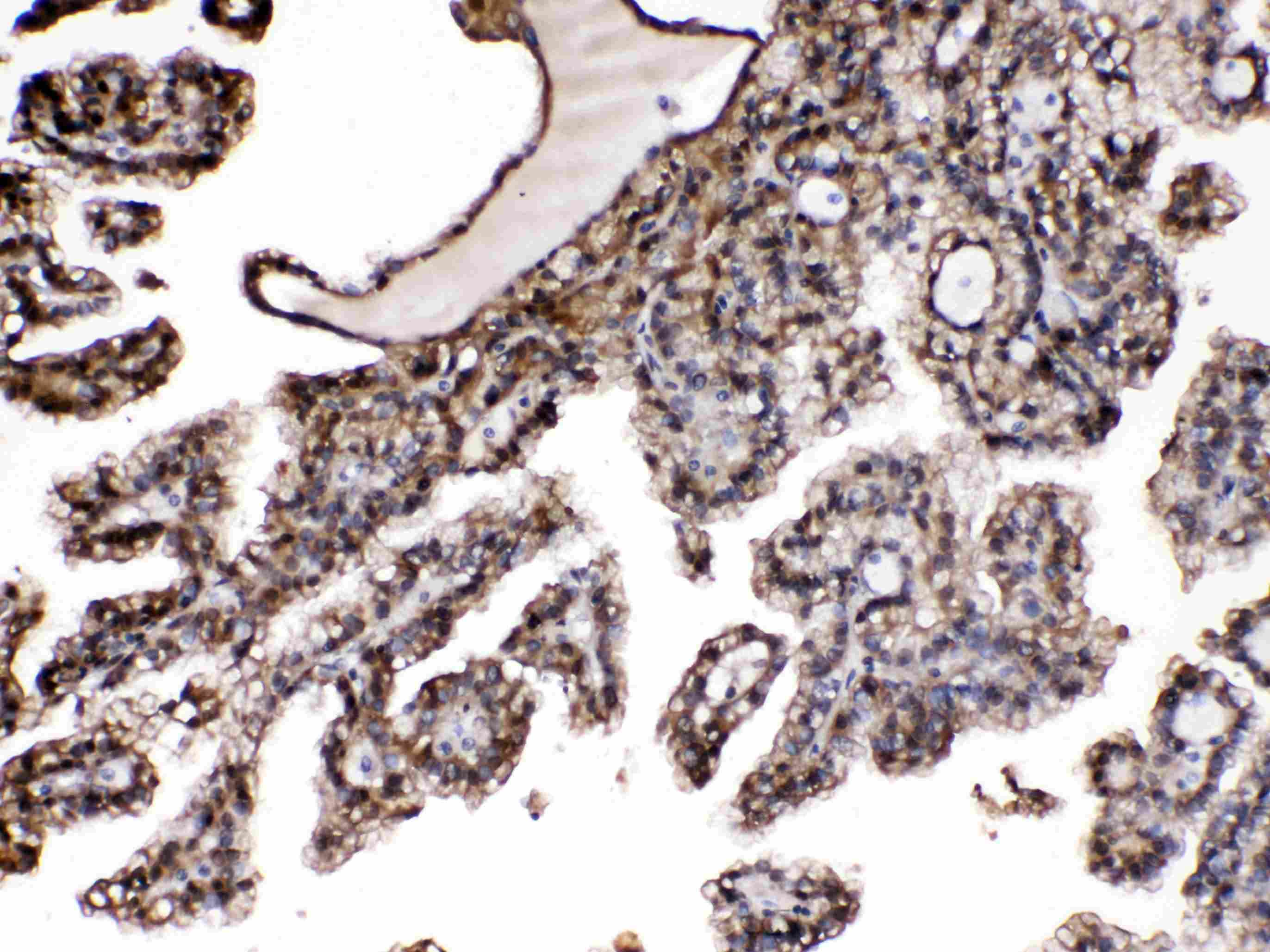 Polyclonal Rabbit anti-Human PNP / Nucleoside Phosphorylase Antibody (IHC, WB)
