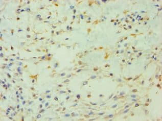 Polyclonal Rabbit anti-Human PIP4K2B Antibody (aa1-270, IHC, WB)
