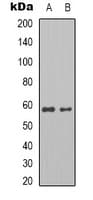 Polyclonal Rabbit anti-Human PKM / Pyruvate Kinase, Muscle Antibody (Internal, WB)