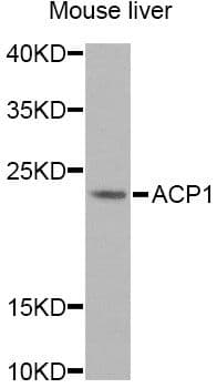 ACP1 / Acid Phosphatase Antibody