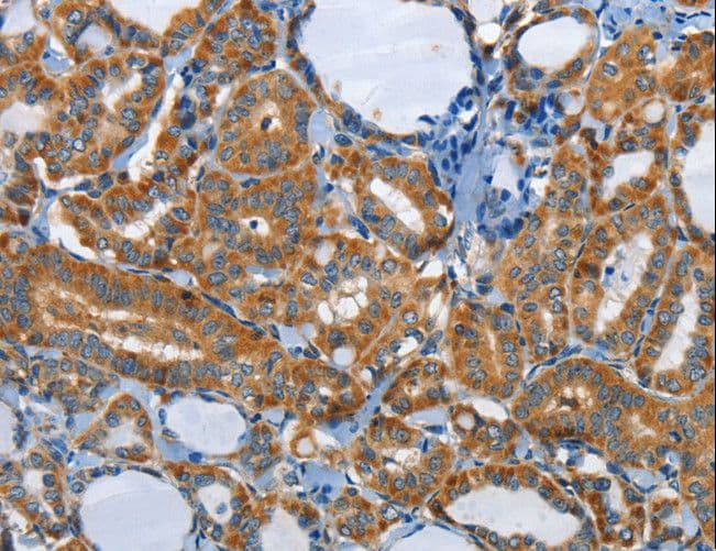 Polyclonal Rabbit anti-Human PIK3R4 Antibody (IHC)
