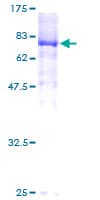 Human YES1 / c-Yes Protein (Recombinant GST)