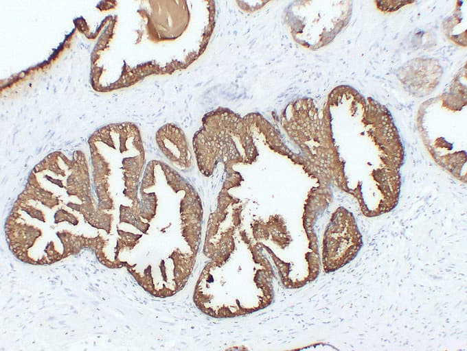 Monoclonal Mouse anti-Human ACPP / PAP Antibody (clone ABT-PSAP, IHC)