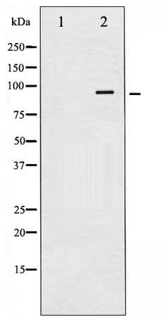 CALD1 / Caldesmon Antibody