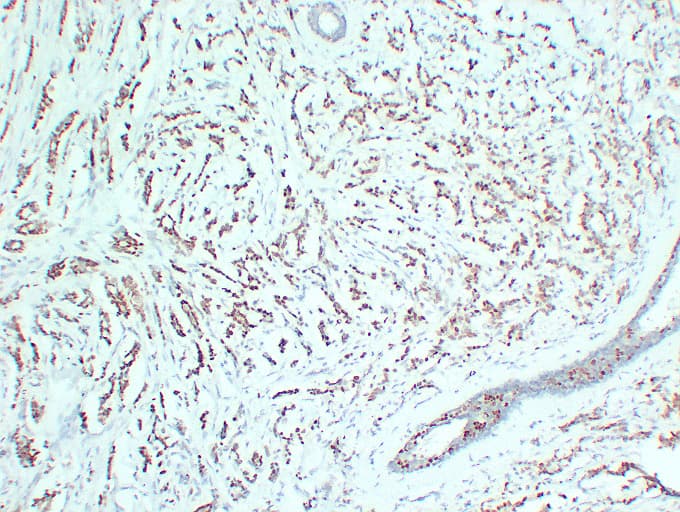 PR / Progesterone Receptor Antibody (clone ABT-PR)