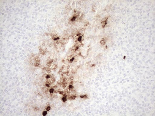 S100A9 / MRP14 Antibody (clone OTI13E12)