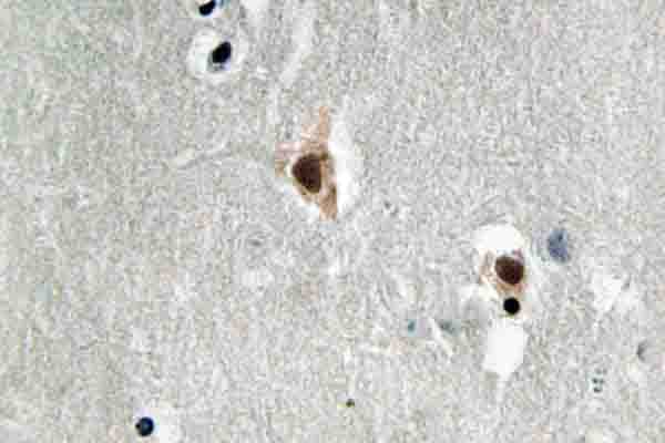 MEF2C Antibody (Ile390)