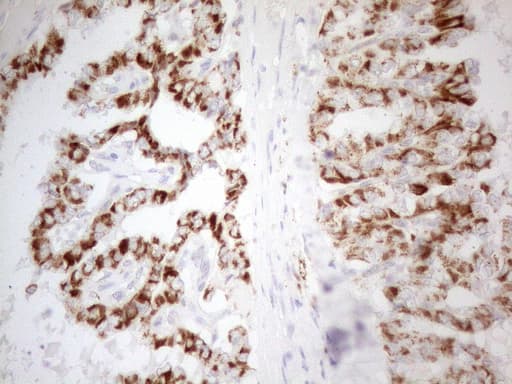 Monoclonal Mouse anti-Human NAPSA / NAPA / Napsin A Antibody (clone OTI3C6, Carrier-free, aa64-244, IHC)
