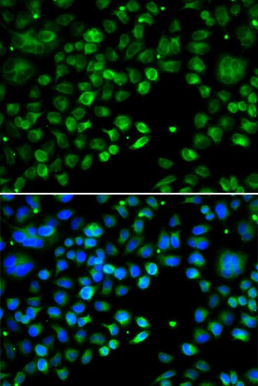 TXNDC5 / ERP46 Antibody