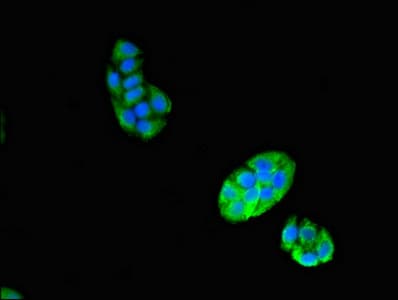 Polyclonal Rabbit anti-Human VPS29 Antibody (IHC, IF, WB)