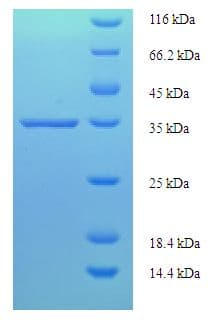 Human D52 / TPD52 Protein (Recombinant His-SUMO)